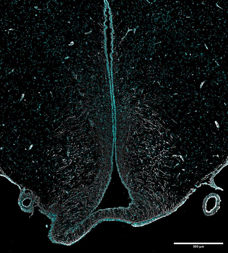 Bilde3_MBH-Vimentin-nuclei-275.jpg