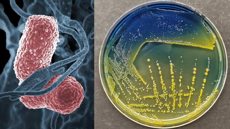 bakterie klebsiella